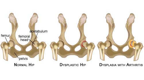 Hip Dysplasia in Dogs | What is Physiotherapy & Rehabilitation For Hip