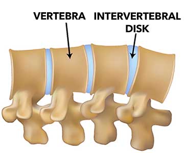 Intervertebral disc in sales dogs